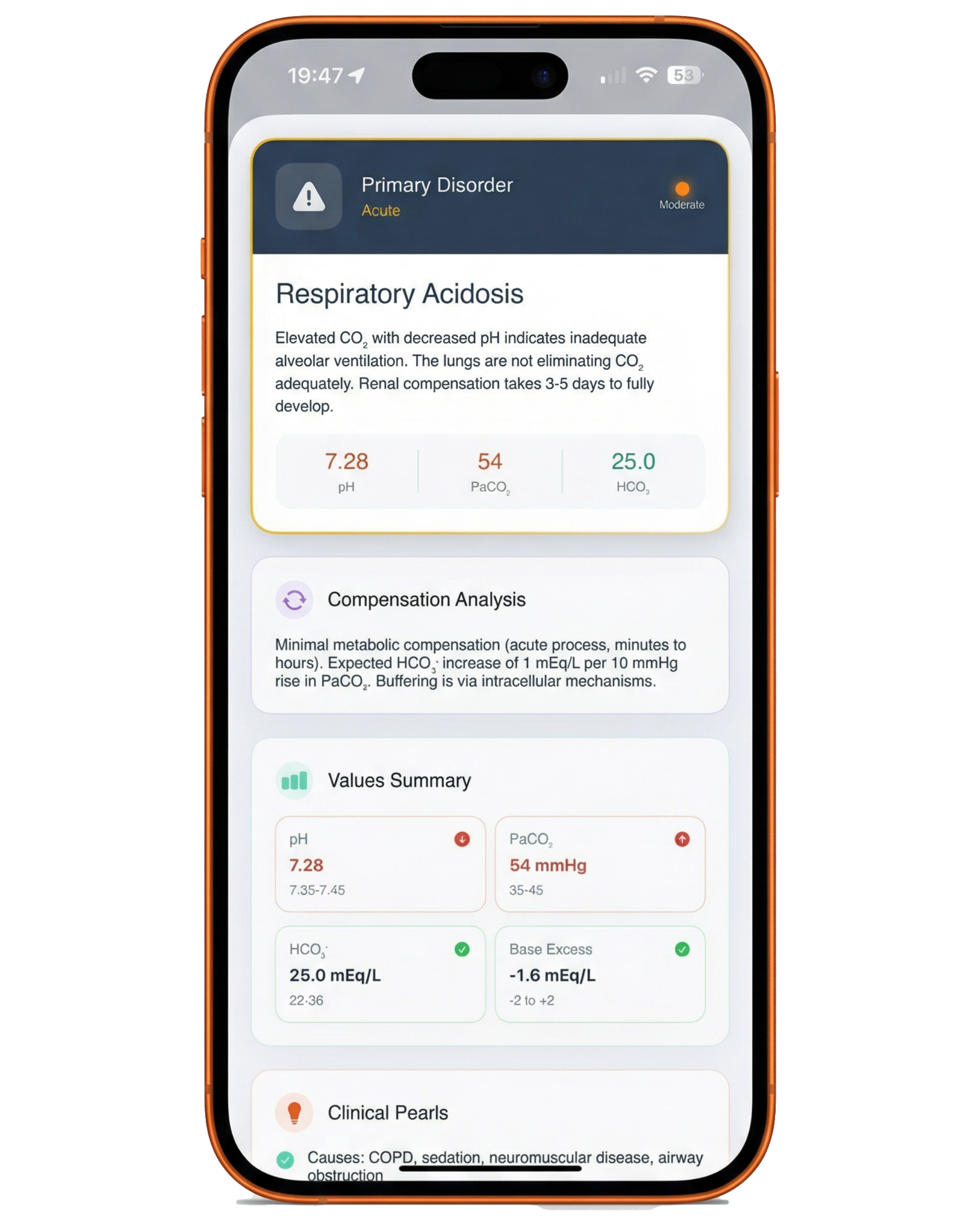 ABG Interpreter showing respiratory acidosis with pH, PaCO2, HCO3 analysis and compensation